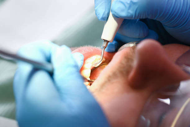 Best Orthodontic Emergency Dentist in Glenville, WV