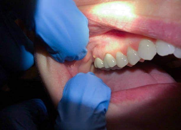 Best Weekend Emergency Dentist in Glenville, WV
