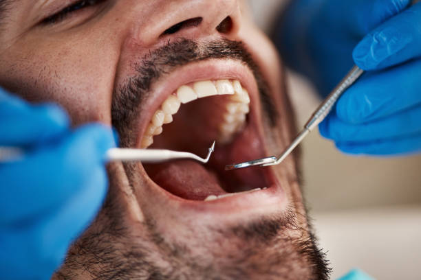 Best Broken or Cracked Tooth Emergency Dentist in Glenville, WV